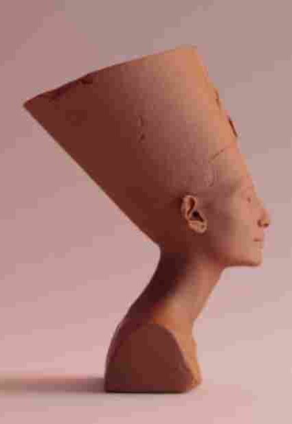 Nefertiti Neck Lift