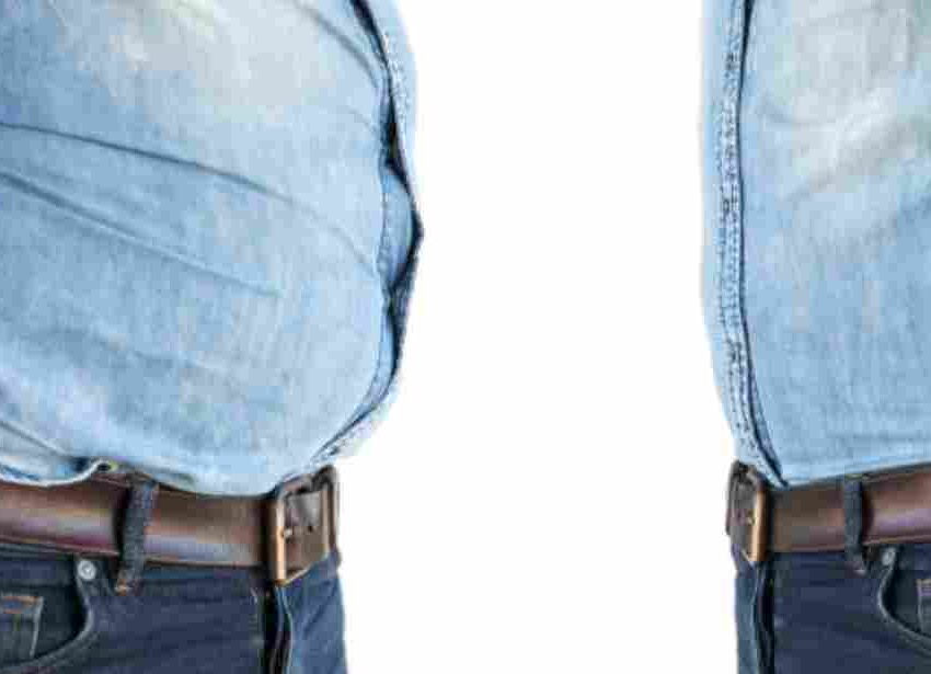 diastasis recti in men