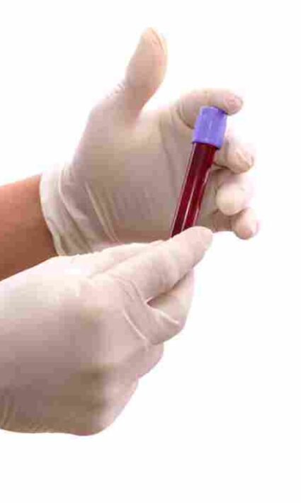 nrbc blood test