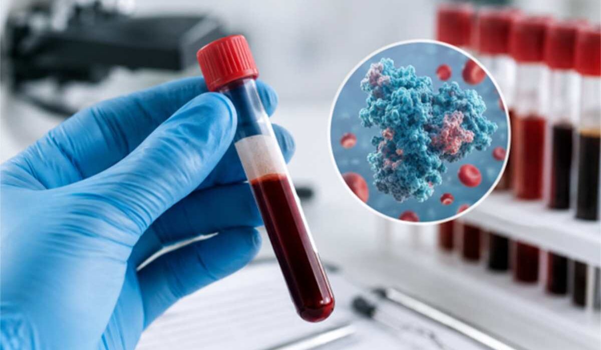 protein test