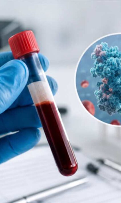 protein test