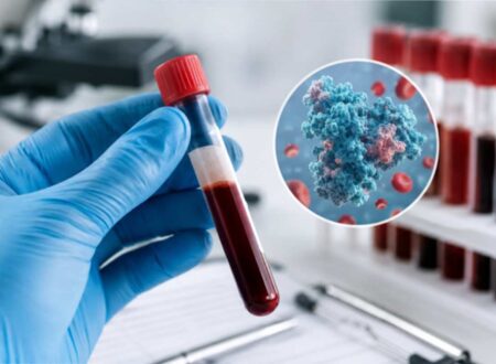 protein test