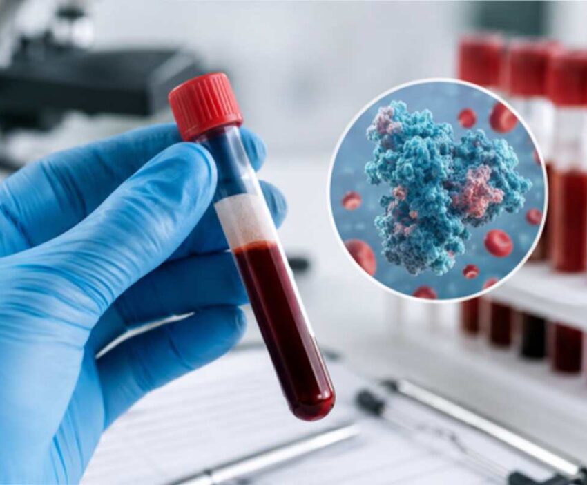 protein test