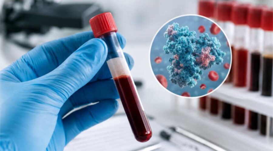 protein test