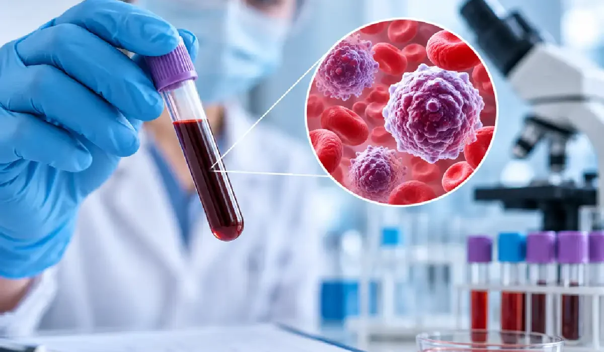 The Blood Test That Can Catch Leukaemia Before Symptoms Appear